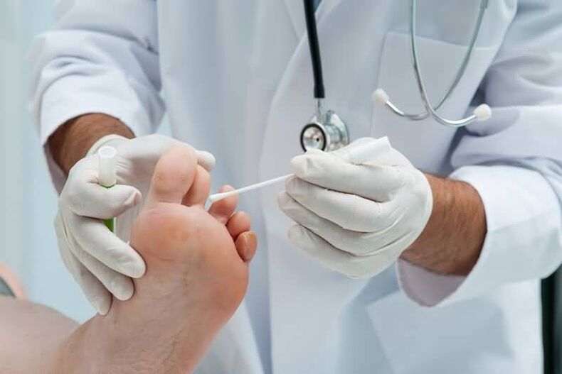 Jeśli masz objawy grzybicy paznokci, powinieneś skonsultować się z dermatologiem lub mykologiem. 