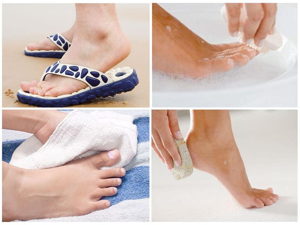 Zapobieganie grzybicy paznokci obejmuje higienę stóp, używanie przedmiotów osobistych i terminowe pedicure